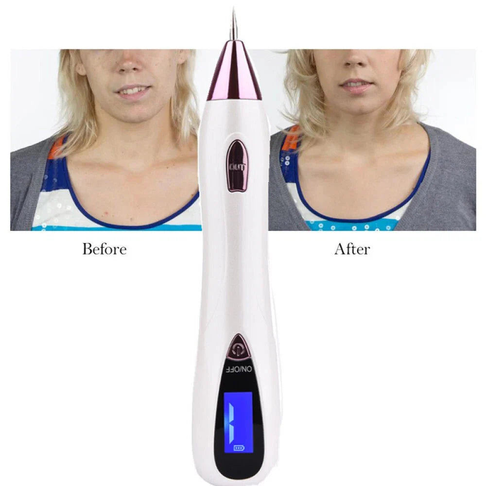 Anti-Aging Laser Plasma Pen Mole Removal Dark Spot Skin Tag Tattoo Wart Remover