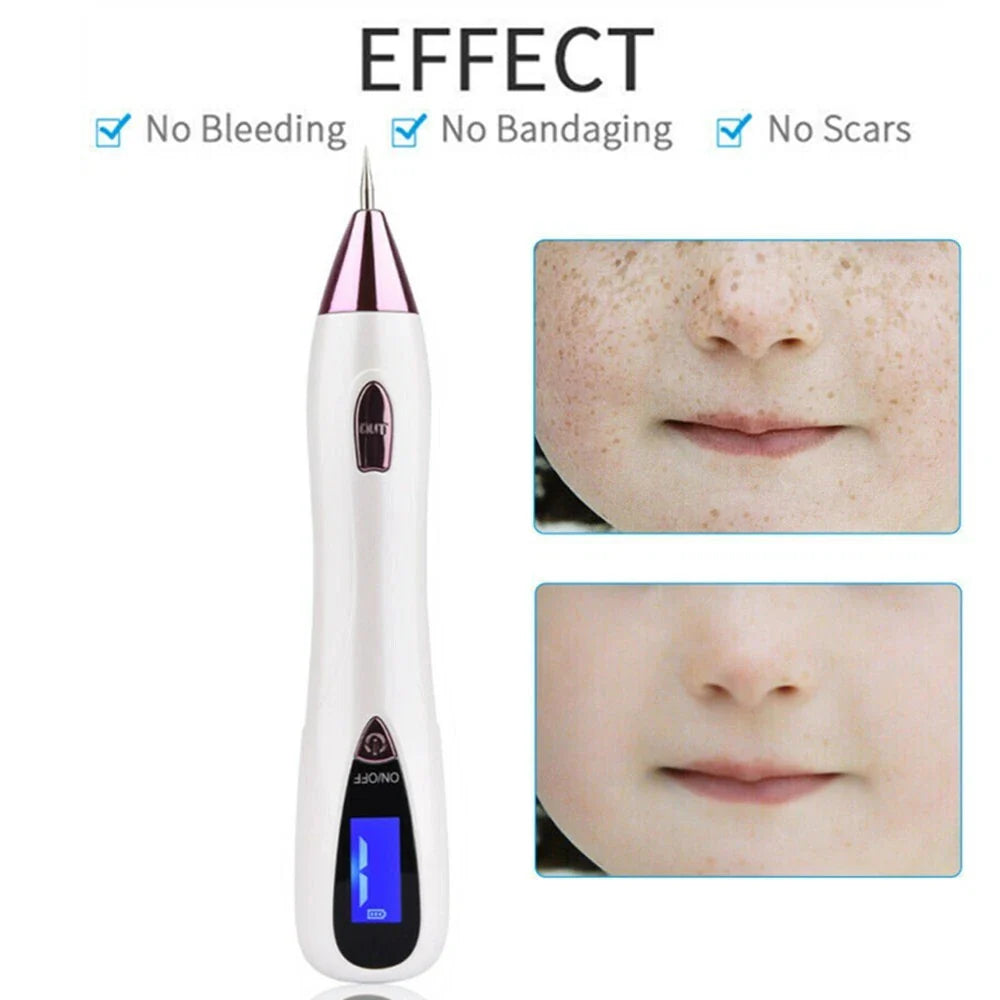 Anti-Aging Laser Plasma Pen Mole Removal Dark Spot Skin Tag Tattoo Wart Remover